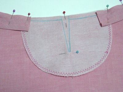 �\�[�C���O���b�X���@�����̍����S