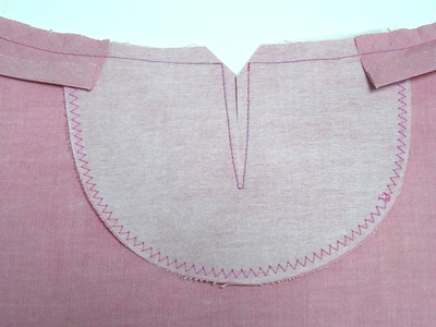 �\�[�C���O���b�X���@�����̍����U