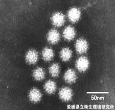 ノロウイルスの電子顕微鏡写真