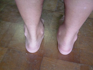 �A�L���X�F�ُ�